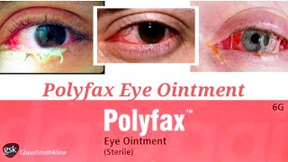 Polyfax eye ointment uses in urdu Hindi [upl. by Aaren]