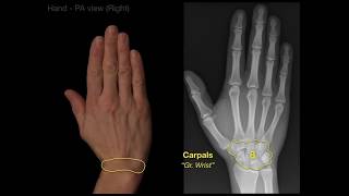 How to Interpret XRays the Basics [upl. by Hairam]