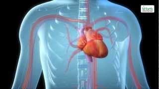 Angioplasty Procedure Animation Video [upl. by Jahn606]