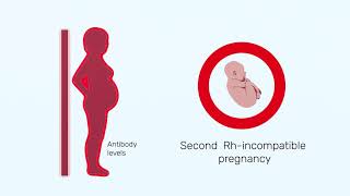 Understanding Rhesus Status and AntiD in Pregnancy [upl. by Akcinahs]