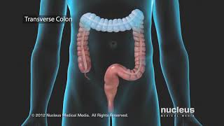 What is Ulcerative Colitis [upl. by Wadleigh]