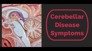 Cerebellar Disease Symptoms [upl. by Shane]