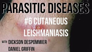 Parasitic Diseases Lectures 6 Cutaneous Leishmaniasis [upl. by Analat]