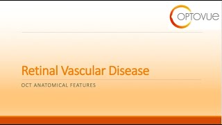 OCT Interpretation Session 4 Retinal Vascular Disease [upl. by Hazrit]