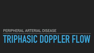 Triphasic Doppler Flow [upl. by Aiselad353]