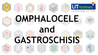 Omphalocele and Gastroschisis [upl. by Odranoel375]