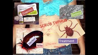 Scrub typhus symptoms diagnosis and protection [upl. by Ryley611]