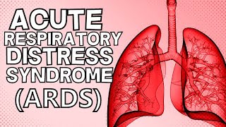 Acute Respiratory Distress Syndrome ARDS [upl. by Millburn]