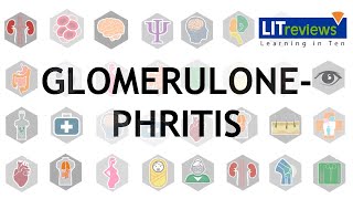 Glomerulonephritis [upl. by Elita]