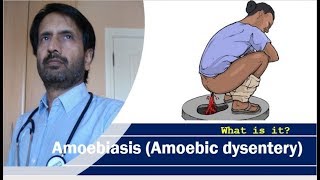 Amoebiasis Amoebic dysentery  Symptoms of dysentery [upl. by Clava]