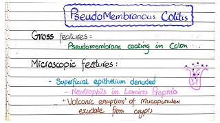 Membranous Nephropathy vs Membranoproliferative Glomerulonephritis [upl. by Soisanahta]