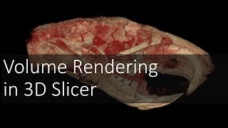 Volume Rendering in 3D Slicer  Introduction to Digital Preparation Video 9 [upl. by Duquette]