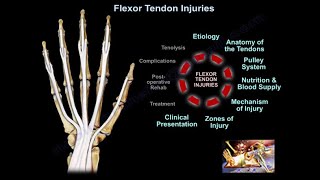 Flexor Tendon Injuries  Everything You Need To Know  Dr Nabil Ebraheim [upl. by Emelia]