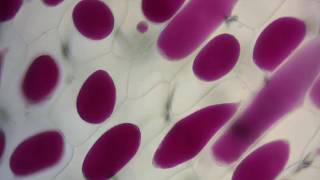 Red onion cell plasmolysis and its reversal [upl. by Minetta]