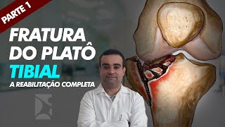 Fratura de Platô Tibial [upl. by Anibor]