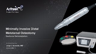 Minimally Invasive Distal Metatarsal Osteotomy [upl. by Row124]