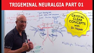 Trigeminal Neuralgia  Causes and Treatment  Part 1 [upl. by Sidnac466]