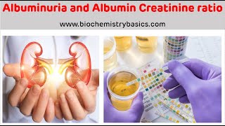 Albuminuria  Albumin Creatinine Ratio  Albumin In Urine [upl. by Trip904]