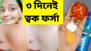 ফর্সা হবার সহজ উপায়েforsa howar sohoj upaytomato facialGlow Facial [upl. by Wickner]