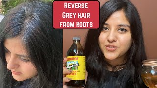 Black Hair Permanently  Reverse Grey Hair Naturally  Ayurvedic Turai Oil  Premature Greying [upl. by Srednas]