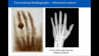 Characteristic XRays  Nuclear Physics [upl. by Noiek]