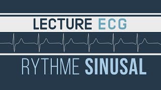 Interprétation ECG  Rythme Sinusal [upl. by Nosloc]