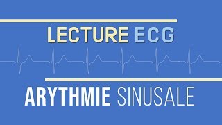 Interprétation ECG  Arythmie Sinusale [upl. by Lilia821]