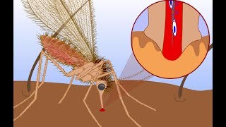 Leishmaniasis life cycle [upl. by Eatnohs]