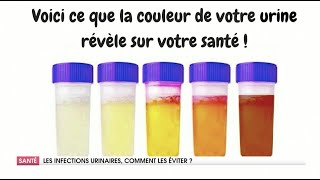 COMMENT TRAITER LES INFECTIONS URINAIRES [upl. by Lagasse]