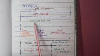 Glomerular diseases [upl. by Ahsoik933]