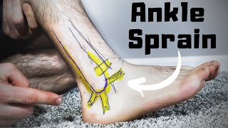 Twisted or Rolled Ankle Sprain Treatment FASTER Home Recovery Time [upl. by Arrek]