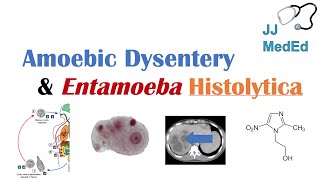 Amebiasis Amoebic Dysentery  Entamoeba histolytica Pathogenesis Signs amp Symptoms Treatment [upl. by Ennyletak]