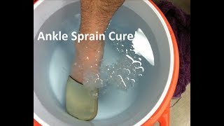 Broken Ankle vs Sprained Ankle Doctor Guide [upl. by Udenihc]