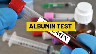 Albumin Test  My Lab Solution [upl. by Aved]