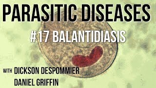 Parasitic Diseases Lectures 17 Balantidiasis [upl. by Dasi]