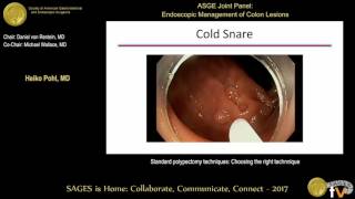 Colorectal polyps  an Osmosis Preview [upl. by Nerok]