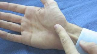 Hand Surface Anatomy  Palm Side [upl. by Norval]